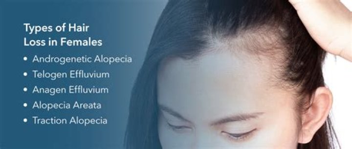 Can androgens cause hair loss?