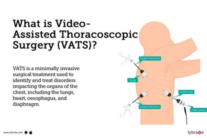 What is a vats procedure?